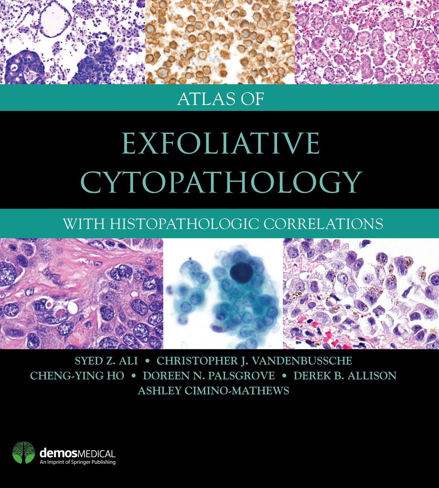 Atlas of Exfoliative Cytopathology: With Histopathologic Correlations