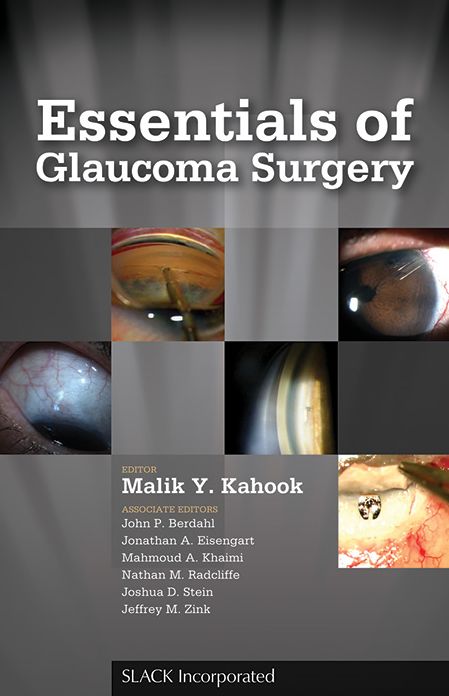 Essentials of Glaucoma Surgery