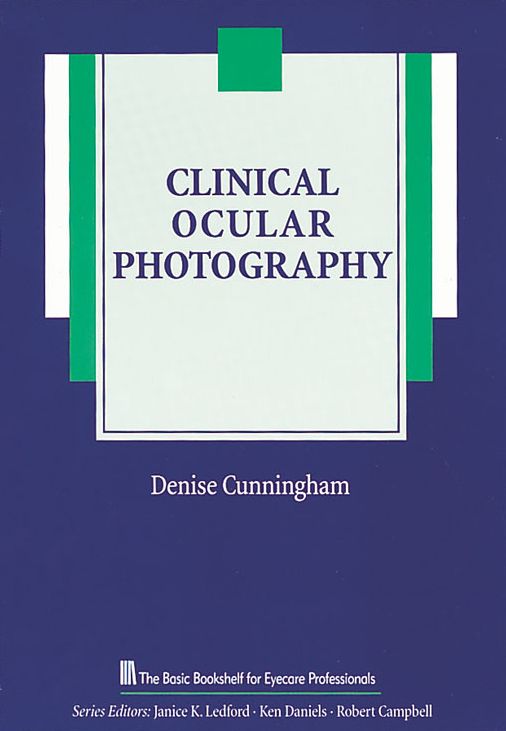 Clinical Ocular Photography