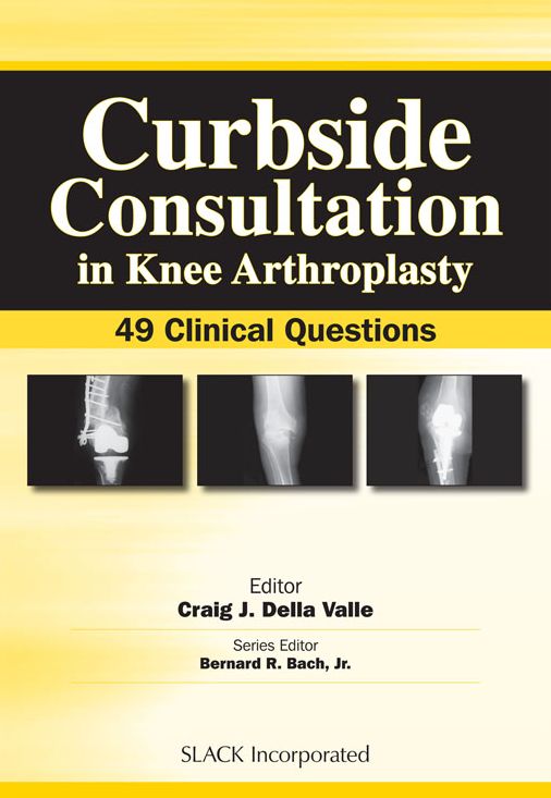 Curbside Consultation in Knee Arthroplasty: 49 Clinical Questions