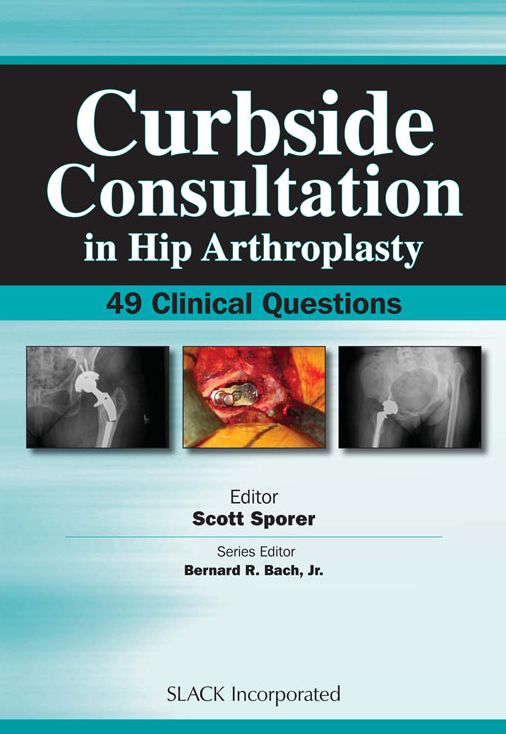 Curbside Consultation in Hip Arthroplasty: 49 Clinical Questions