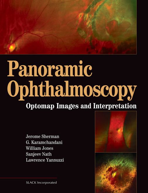 Panoramic Ophthalmoscopy: Optomap? Images and Interpretation