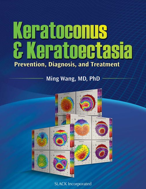 Keratoconus and Keratoectasia: Prevention, Diagnosis, and Treatment