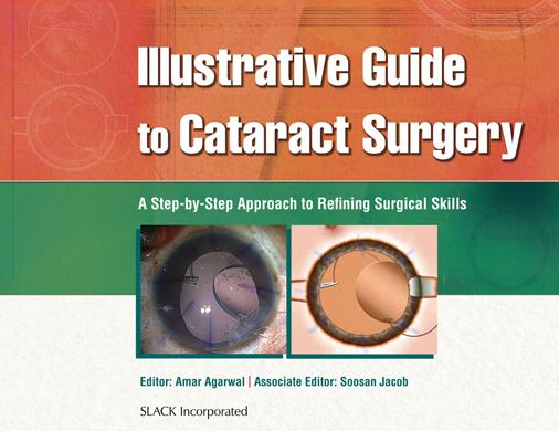 Illustrative Guide to Cataract Surgery: A Step-by-Step Approach to Refining Surgical Skills