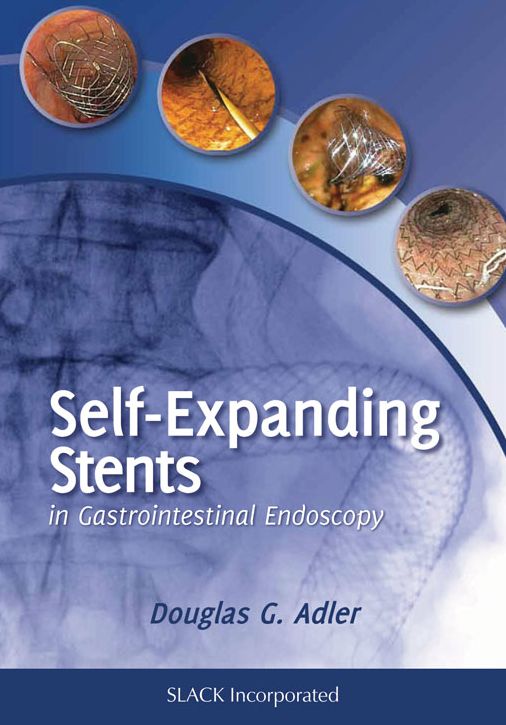 Self Expanding Stents in Gastroenterology
