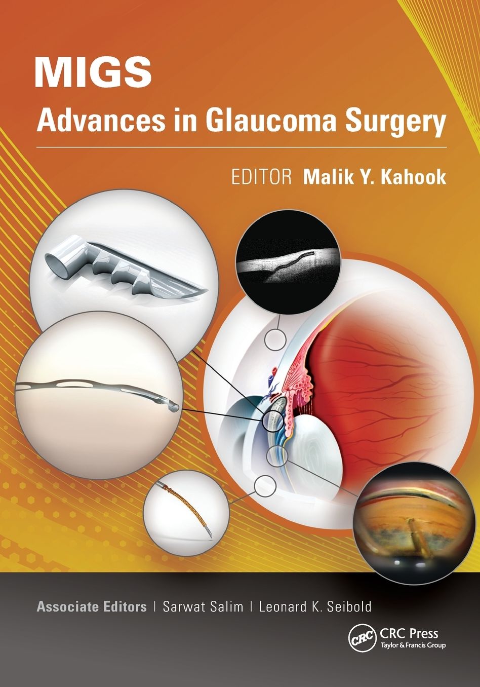 Minimally Invasive Glaucoma Surgery: An Introduction to Basic Principles and Pearls for Practice