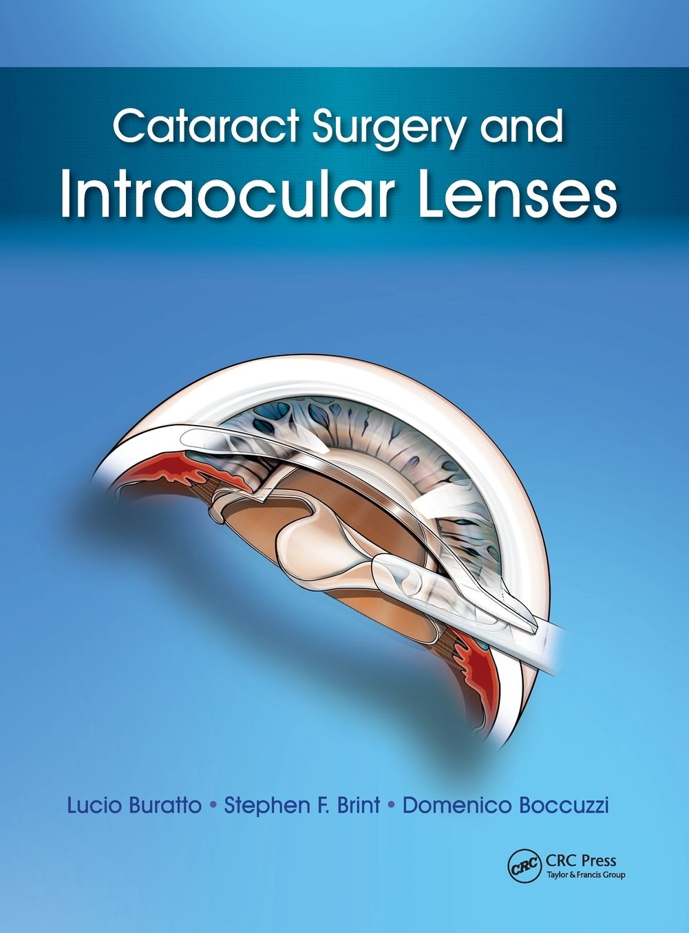 Cataract Surgery: Intraocular Lenses