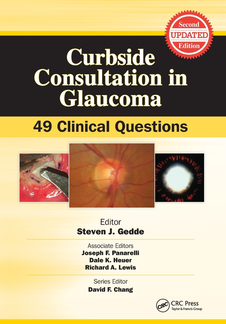 Curbside Consultation in Glaucoma: 49 Clinical Questions