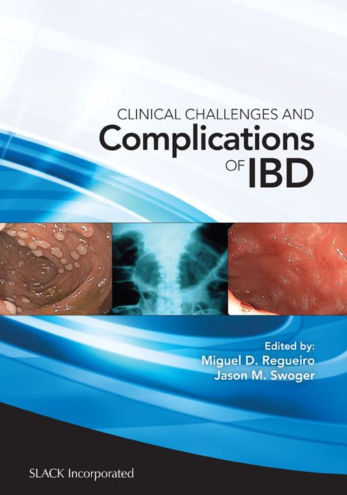Clinical Challenges and Complications of IBD