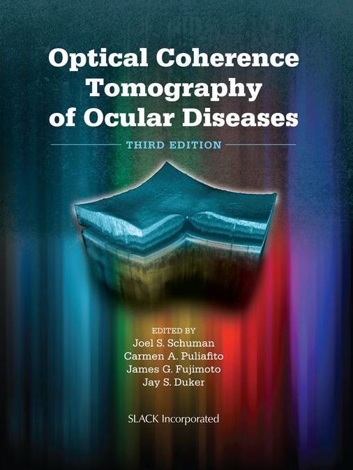 Optical Coherence Tomography of Ocular Diseases: Third Edition