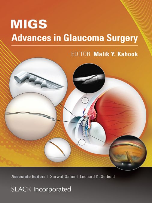 MIGS: Advances in Glaucoma Surgery