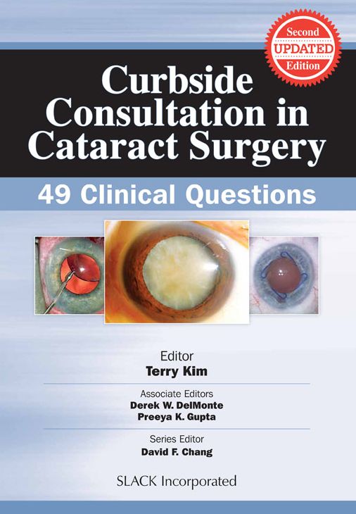 Curbside Consultation in Cataract Surgery: 49 Clinical Questions, Second Edition