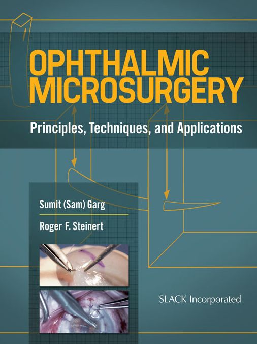 Ophthalmic Microsurgery: Principles, Techniques, and Applications