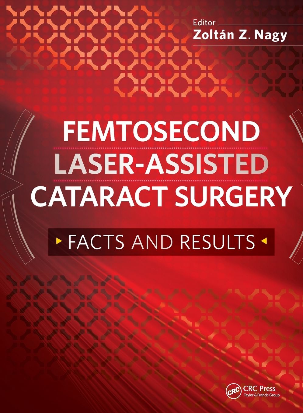 Femtosecond Laser-Assisted Cataract Surgery: Facts and Results