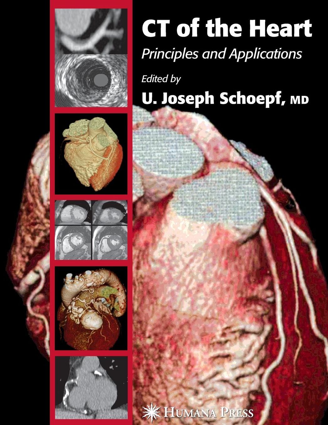 CT of the Heart: Principles and Applications