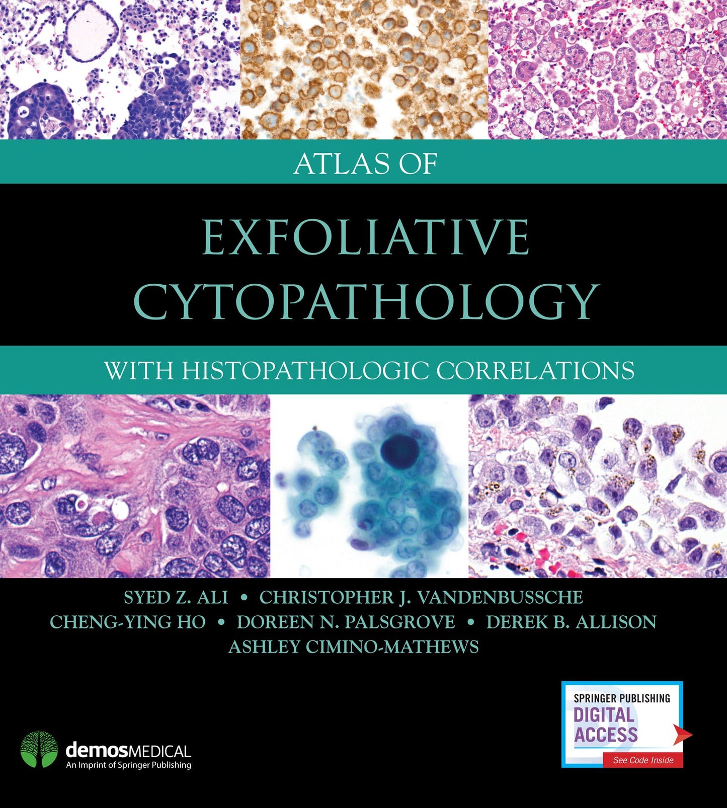 Atlas of Exfoliative Cytopathology: With Histopathologic Correlations