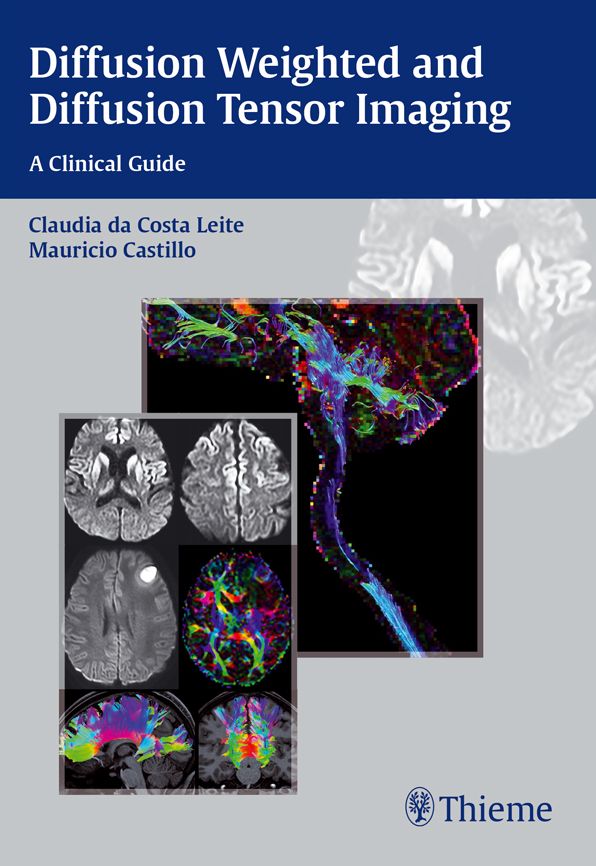 Diffusion Weighted and Diffusion Tensor Imaging: A Clinical Guide: A Clinical Guide