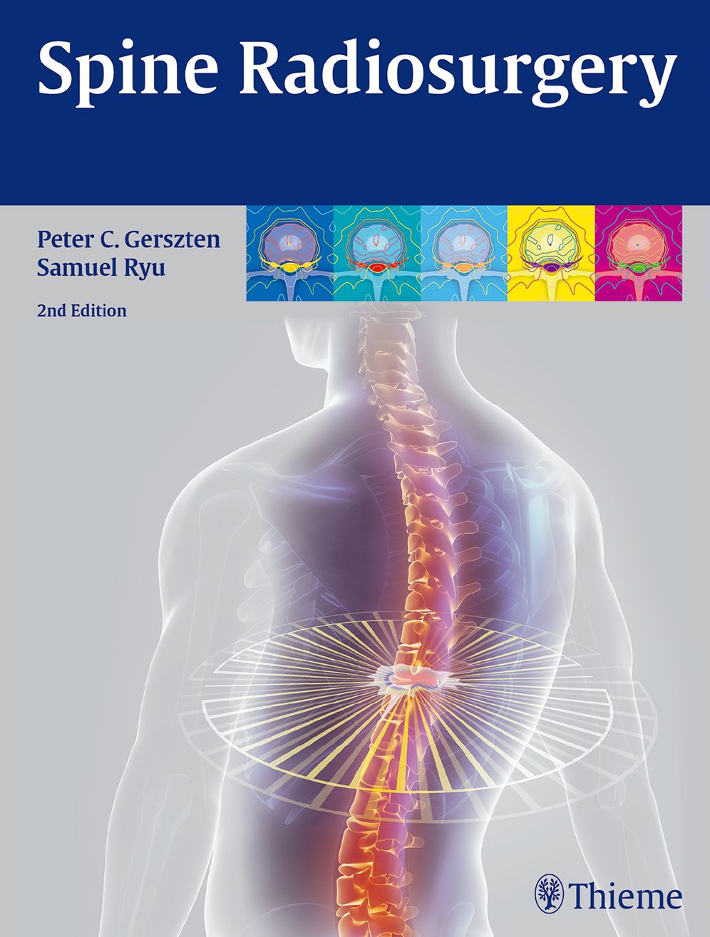Spine Radiosurgery