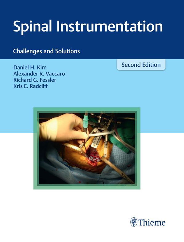 Spinal Instrumentation: Challenges and Solutions