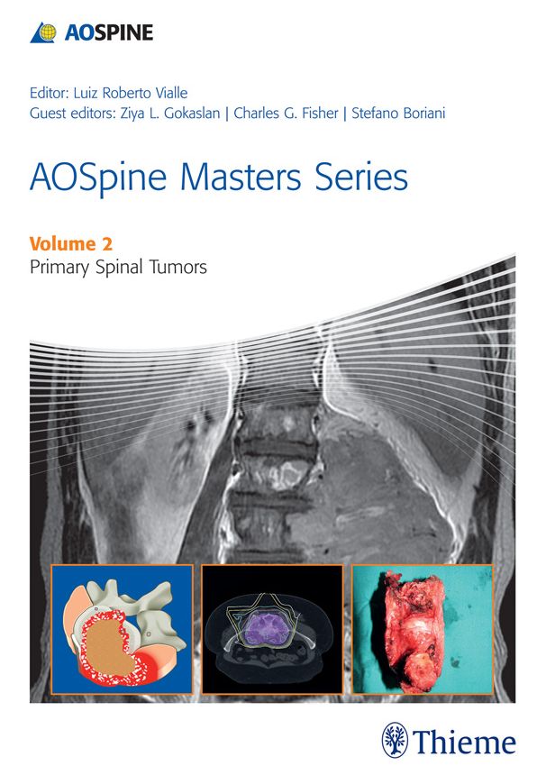 AOSpine Masters Series Volume 2: Primary Spinal Tumors
