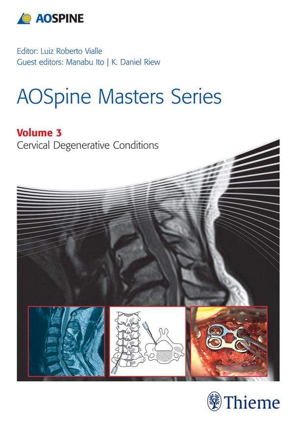 AOSpine Masters Series Volume 3: Cervical Degenerative Conditions