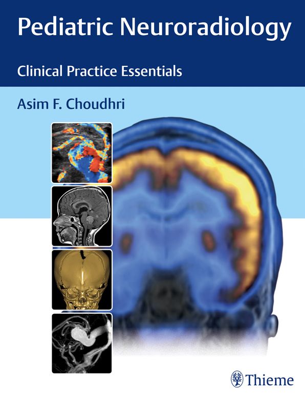 Pediatric Neuroradiology: The Essentials