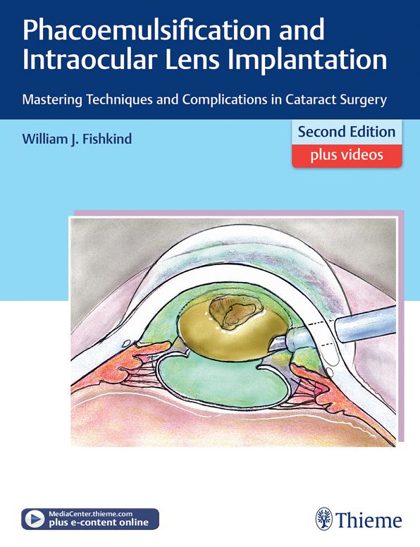 Phacoemulsification and Intraocular Lens Implantation: Mastering Techniques and Complications in Cataract Surgery