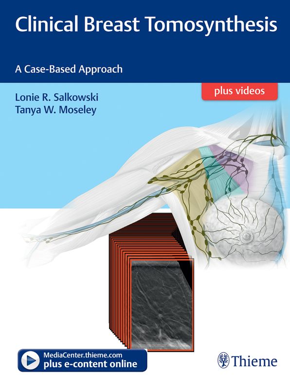 Clinical Breast Tomosynthesis: A Case-Based Approach