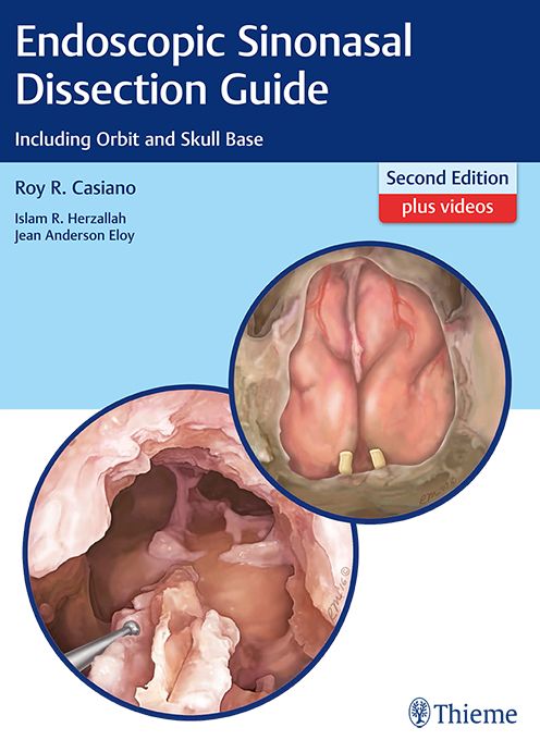 Endoscopic Sinonasal Dissection Guide: Including Orbit and Skull Base