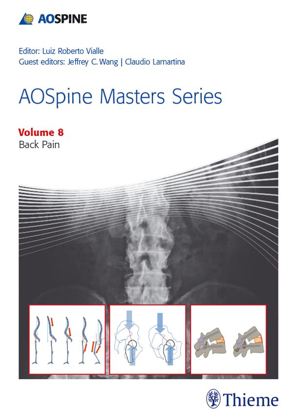 AOSpine Masters Series, Volume 8: Back Pain
