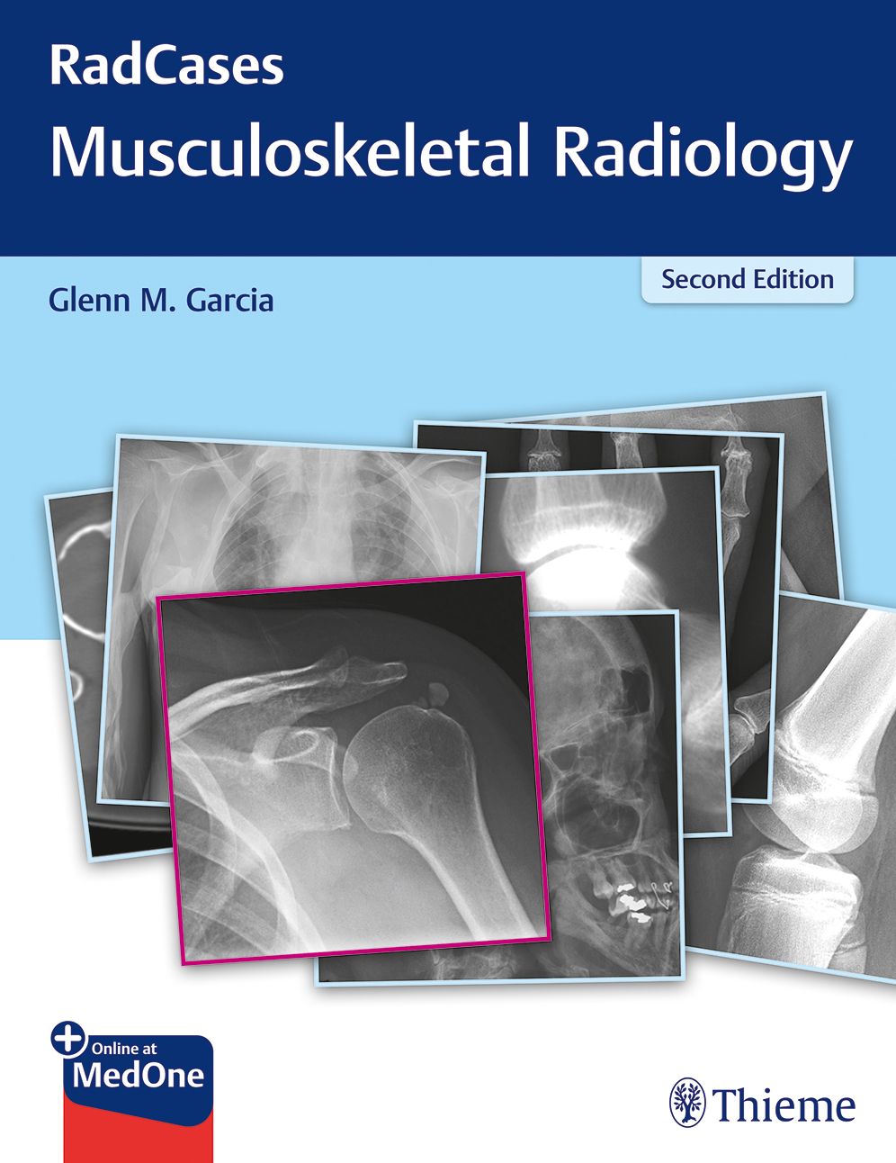 Radcases Musculoskeletal Radiology