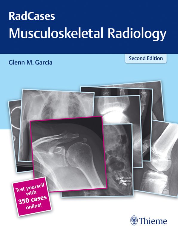 RadCases Q&A Musculoskeletal Radiology