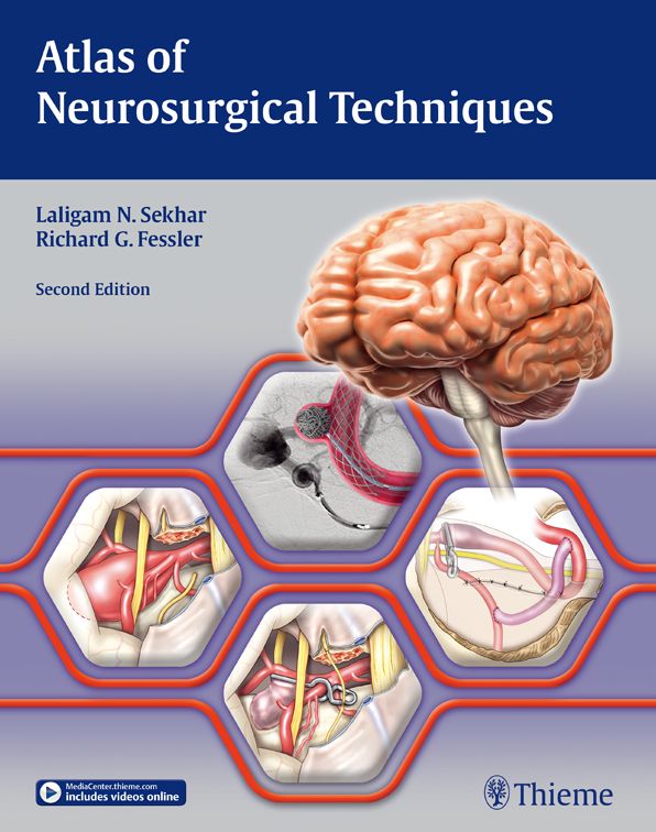 Atlas of Neurosurgical Techniques: Brain