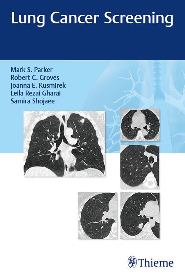 Lung Cancer Screening
