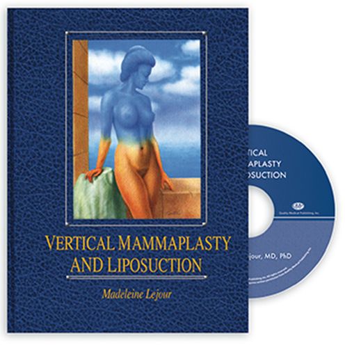 Vertical Mammaplasty and Liposuction