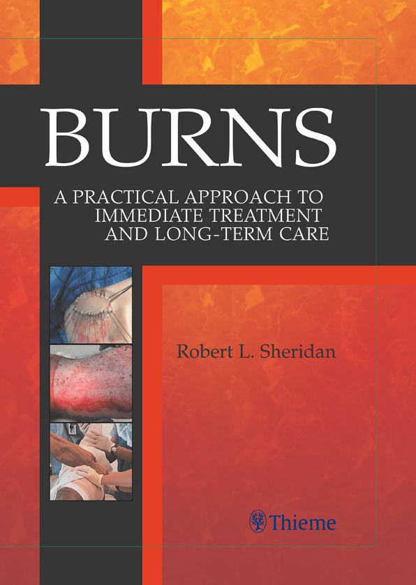 Burns: A Practical Approach to Immediate Treatment and Long Term Care
