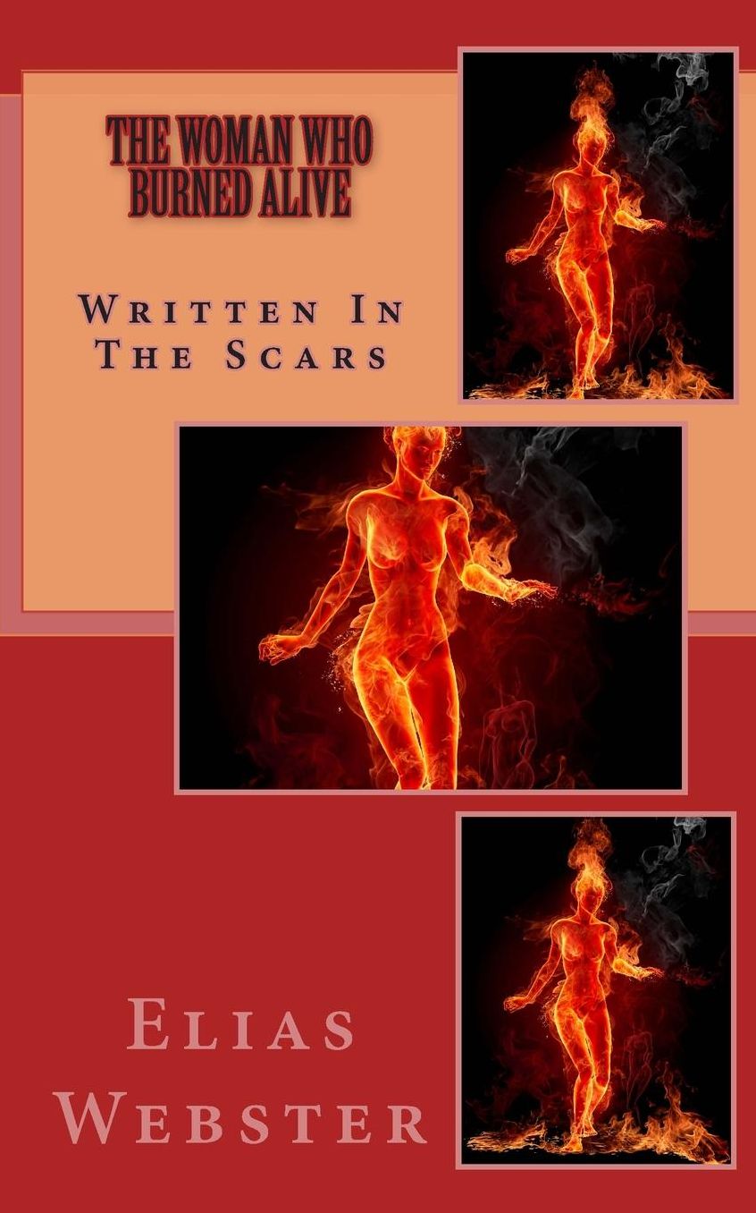 The Woman Who Burned Alive: It's Written In The Scars
