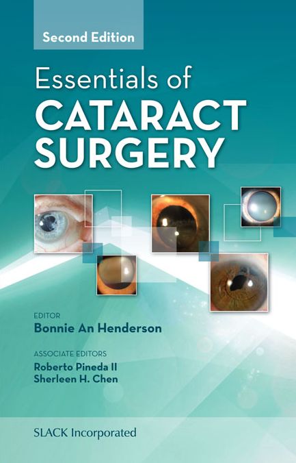 Essentials of Cataract Surgery, Second Edition