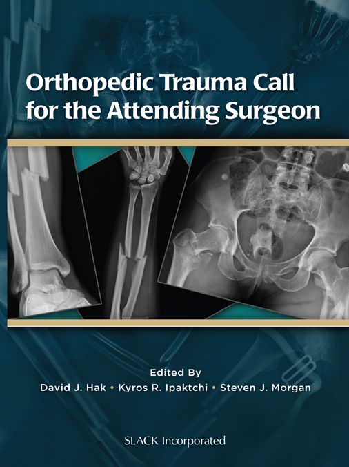 Orthopedic Trauma Call for the Attending Surgeon