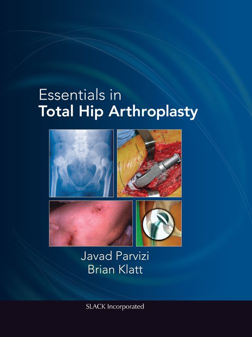 Essentials in Total Hip Arthroplasty