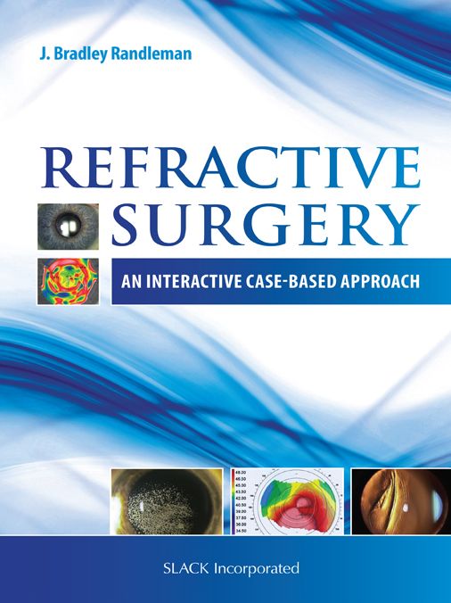 Refractive Surgery: An Interactive Case-Based Approach