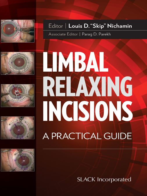 Limbal Relaxing Incisions: A Practical Guide