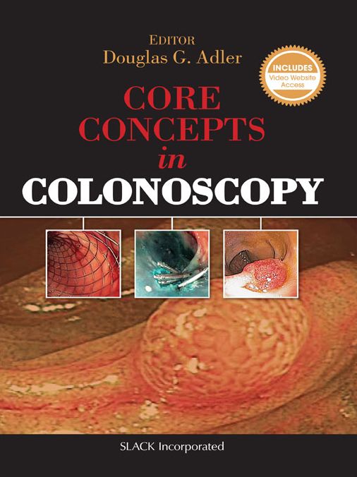 Core Concepts in Colonoscopy