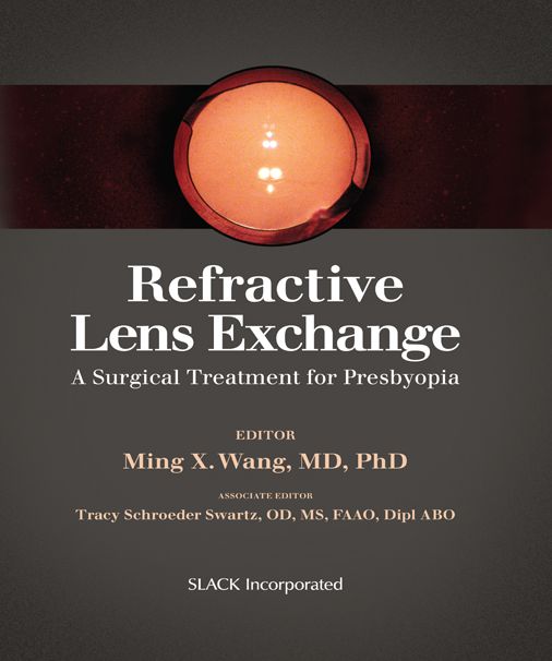Refractive Lens Exchange: A Surgical Treatment for Presbyopia