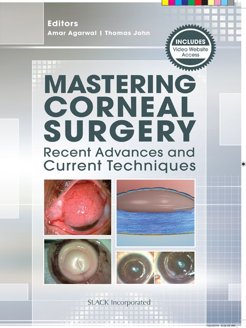 Mastering Corneal Surgery: Recent Advances and Current Techniques