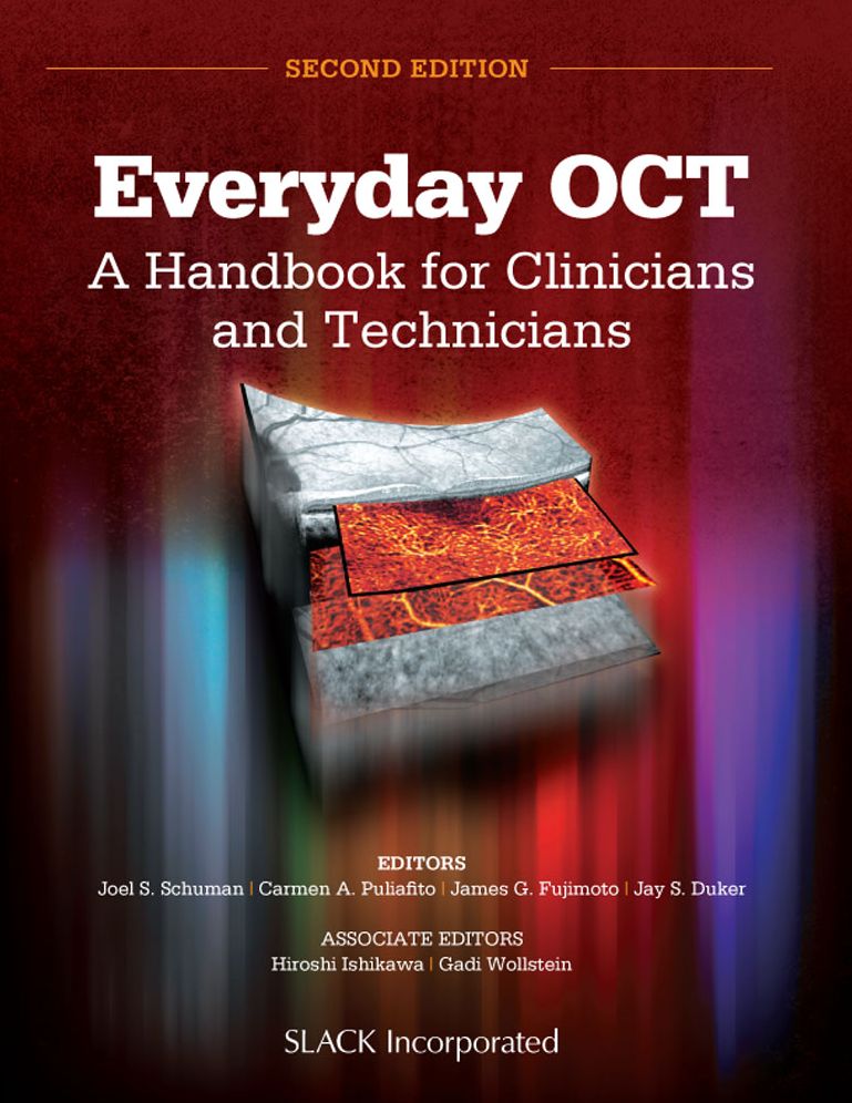 Everyday OCT: A Handbook for Clinicians and Technicians
