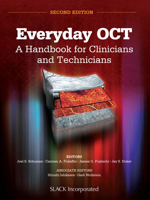 Everyday OCT: A Handbook for Clinicians and Technicians, Second Edition