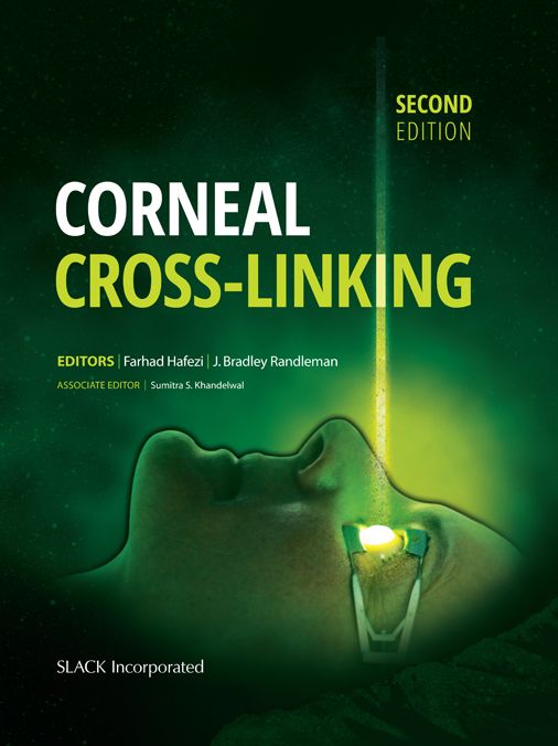 Corneal Cross-Linking, Second Edition