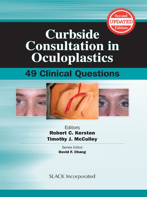 Curbside Consultation in Oculoplastics: 49 Clinical Questions, Second Edition