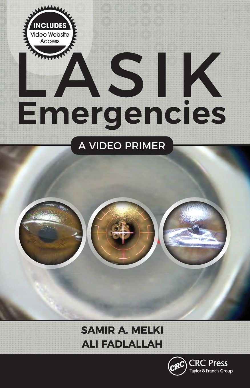 Lasik Emergencies: A Video Primer